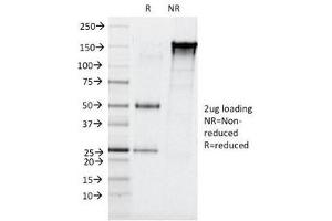 SDS-PAGE Analysis of Purified, BSA-Free Elastase 3B Antibody (clone CELA3B/1257).