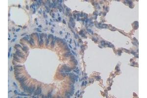 anti-Inhibin, beta B (INHBB) (AA 297-411) antibody