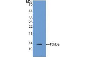 Detection of Recombinant Trx, Human using Polyclonal Antibody to Thioredoxin (Trx) (TXN anticorps  (AA 1-105))