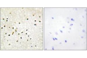 Immunohistochemistry analysis of paraffin-embedded human brain tissue, using TF2H1 Antibody. (GTF2H1 anticorps  (AA 15-64))