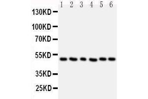 Anti-HDAC3 antibody,  Western blotting Lane 1: Rat Stomach Tissue Lysate Lane 2: Rat Testis Tissue Lysate Lane 3: MCF-7 Cell Lysate Lane 4: HELA Cell Lysate Lane 5: JURKAT Cell Lysate Lane 6: SKOV Cell Lysate (HDAC3 anticorps  (C-Term))