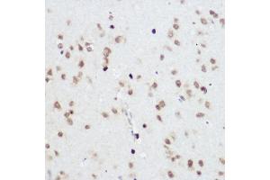 Immunohistochemistry of paraffin-embedded Rat brain using PLZF antibody (ABIN6128472, ABIN6150368, ABIN6150369 and ABIN6221570) at dilution of 1:200 (40x lens). (ZBTB16 anticorps  (AA 1-220))