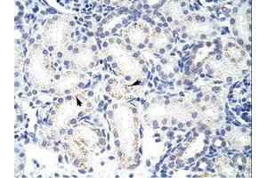 Image no. 1 for anti-Small Nuclear Ribonucleoprotein Polypeptide A (SNRPA) (AA 176-225) antibody (ABIN203017)