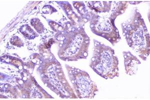 IHC analysis of cortactin using anti-cortactin antibody (ABIN6719306). (Cortactin anticorps  (AA 1-105))