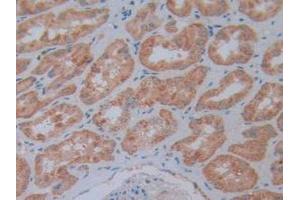 IHC-P analysis of Human Kidney Tissue, with DAB staining. (NT5C3 anticorps  (AA 52-336))