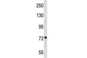 MFN1 antibody western blot analysis in Jurkat lysate.