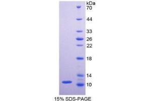 SDS-PAGE of Protein Standard from the Kit (Highly purified E.