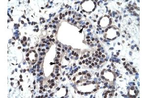 ZNF499 antibody was used for immunohistochemistry at a concentration of 4-8 ug/ml to stain Epithelial cells of collecting tubule (arrows) in Human Kidney. (ZBTB45 anticorps  (Middle Region))