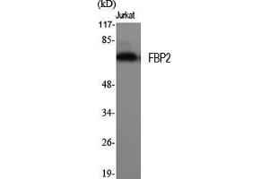 Western Blot (WB) analysis of specific cells using FBP2 Polyclonal Antibody. (FBP2 anticorps  (N-Term))