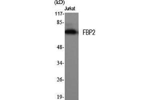 Western Blot (WB) analysis of specific cells using FBP2 Polyclonal Antibody. (FBP2 anticorps  (N-Term))
