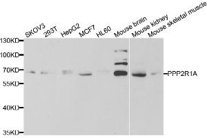 Western blot analysis of extracts of various cell lines, using PPP2R1A antibody. (PPP2R1A anticorps)