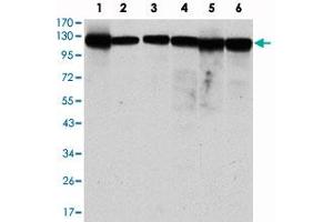 Western blot analysis using MCM2 monoclonal antibody, clone 1E7  against MCF-7 (1), HeLa (2), Jurkat (3), K-562 (4), HEK293 (5) and HEPG2 (6) cell lysate. (MCM2 anticorps)