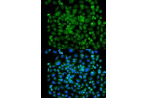 Immunofluorescence analysis of A549 cell using PSMB8 antibody.