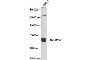 Western blot analysis of extracts of 22Rv1 cells using TMPRSS2 Polyclonal Antibody at dilution of 1:2000.