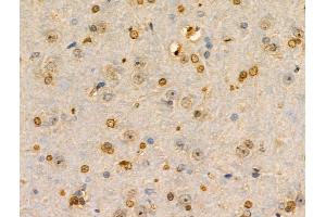 ABIN6259152 and ABIN6274301 at 1/100 staining Rat brain tissue by IHC-P.