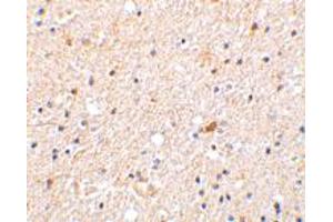 Immunohistochemistry of NGFRAP1 in human brain tissue with NGFRAP1 polyclonal antibody  at 2 ug/mL . (Nerve Growth Factor Receptor (TNFRSF16) Associated Protein 1 (NGFRAP1) (Internal Region) anticorps)