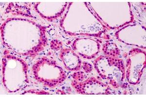 Human Thyroid: Formalin-Fixed, Paraffin-Embedded (FFPE)