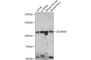 anti-Zinc Finger and SCAN Domain Containing 20 (ZSCAN20) (AA 1-200) antibody