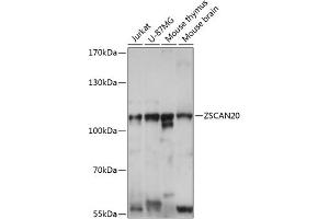 Western blot analysis of extracts of various cell lines, using ZSC antibody (ABIN7271443) at 1:1000 dilution. (ZSCAN20 anticorps  (AA 1-200))