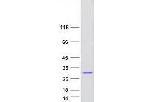 Validation with Western Blot
