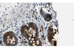 ABIN6269192 at 1/100 staining Mouse intestine tissue by IHC-P. (CBL anticorps  (Internal Region))