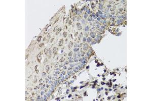 Immunohistochemistry of paraffin-embedded human esophagus using GBF1 antibody at dilution of 1:100 (x40 lens).
