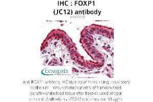 Image no. 1 for anti-Forkhead Box P1 (FOXP1) antibody (ABIN5693578) (FOXP1 anticorps)