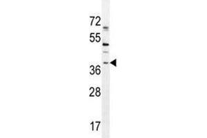 SOX1 antibody western blot analysis in NCI-H460 lysate. (SOX1 anticorps  (AA 47-76))