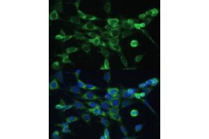 Immunofluorescence analysis of NIH-3T3 cells using COX6 Polyclonal Antibody (ABIN6132108, ABIN6138915, ABIN6138916 and ABIN6220368) at dilution of 1:100 (40x lens). (COX6A1 anticorps  (AA 25-109))
