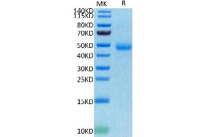 Human SIRP Gamma on Tris-Bis PAGE under reduced conditions.