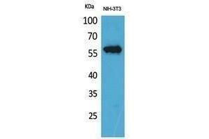 Western Blotting (WB) image for anti-Lymphocyte-Activation Gene 3 (LAG3) (Internal Region) antibody (ABIN6285381)