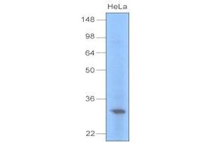 Cell lysates of HeLa (30 ug) were resolved by SDS-PAGE, transferred to PVDF membrane and probed with anti-human UNG (1:1000). (UNG anticorps  (AA 1-313))