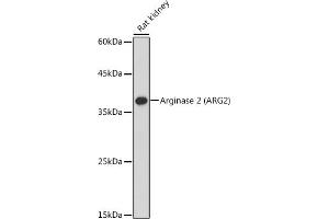 Western blot analysis of extracts of Rat kidney, using Arginase 2  antibody (ABIN6131236, ABIN6137078, ABIN6137079 and ABIN6221969) at 1:1000 dilution. (ARG2 anticorps  (AA 1-354))