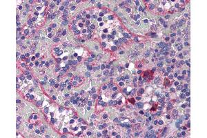 Anti-COPB2 antibody IHC of human spleen.