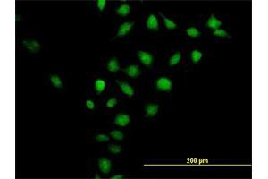 Immunofluorescence of purified MaxPab antibody to CNNM3 on HeLa cell.