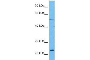 Host:  Rabbit  Target Name:  CACNG1  Sample Tissue:  Human Lung Tumor  Antibody Dilution:  1ug/ml (CACNG1 anticorps  (N-Term))