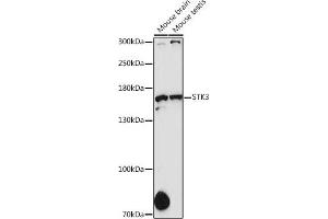 Western blot analysis of extracts of various cell lines, using STK36 antibody (ABIN6135016, ABIN6148614, ABIN6148615 and ABIN7101365) at 1:1000 dilution.