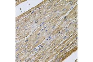 Immunohistochemistry of paraffin-embedded rat heart using CDH16 antibody.