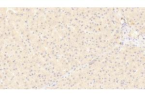 Detection of LRP5 in Human Liver Tissue using Polyclonal Antibody to Low Density Lipoprotein Receptor Related Protein 5 (LRP5) (LRP5 anticorps  (AA 769-1016))