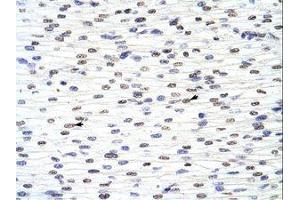 Image no. 1 for anti-Acidic (Leucine-Rich) Nuclear phosphoprotein 32 Family, Member A (ANP32A) (N-Term) antibody (ABIN202122)