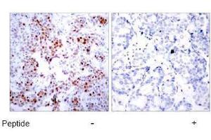 Image no. 1 for anti-Activating Transcription Factor 2 (ATF2) (Ser44), (Ser62) antibody (ABIN197144)