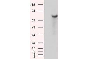 Image no. 4 for anti-Bruton Agammaglobulinemia tyrosine Kinase (BTK) antibody (ABIN1496972) (BTK anticorps)