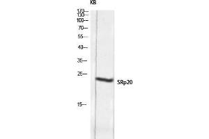 Western Blot (WB) analysis of KB lysis using SRp20 antibody.