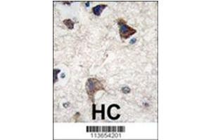 Image no. 2 for anti-Cadherin 4 (CDH4) (AA 182-211), (N-Term) antibody (ABIN356865)