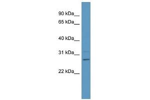 PSPH antibody used at 1 ug/ml to detect target protein. (PSPH anticorps  (Middle Region))
