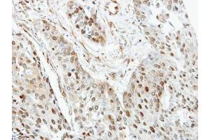 IHC-P Image Immunohistochemical analysis of paraffin-embedded human Trachea, using RanGAP1, antibody at 1:100 dilution.