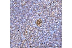 IHC analysis of Hemoglobin/HBA1/HBA2 using anti-Hemoglobin/HBA1/HBA2 antibody (ABIN7602893).