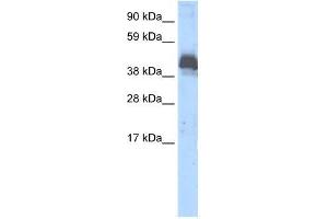 Human Thymus; WB Suggested Anti-ZNF297B Antibody Titration: 0. (ZBTB43 anticorps  (Middle Region))