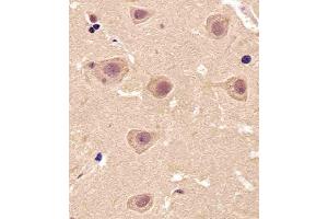 Paraformaldehyde-fixed, paraffin embedded Human brain tissue, Antigen retrieval by boiling in sodium citrate buffer (pH6.