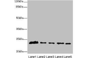 Western blot All lanes: MMD2 antibody at 3 μg/mL Lane 1: Mouse brain tissue Lane 2: Mouse kidney tissue Lane 3: U251 whole cell lysate Lane 4: 293T whole cell lysate Lane 5: Mouse liver tissue Secondary Goat polyclonal to rabbit IgG at 1/10000 dilution Predicted band size: 32, 29, 23 kDa Observed band size: 23 kDa (MMD2 anticorps  (AA 1-38))